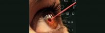 New surgery could end the need for reading glasses
