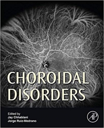 Book Choroidal Disorders
